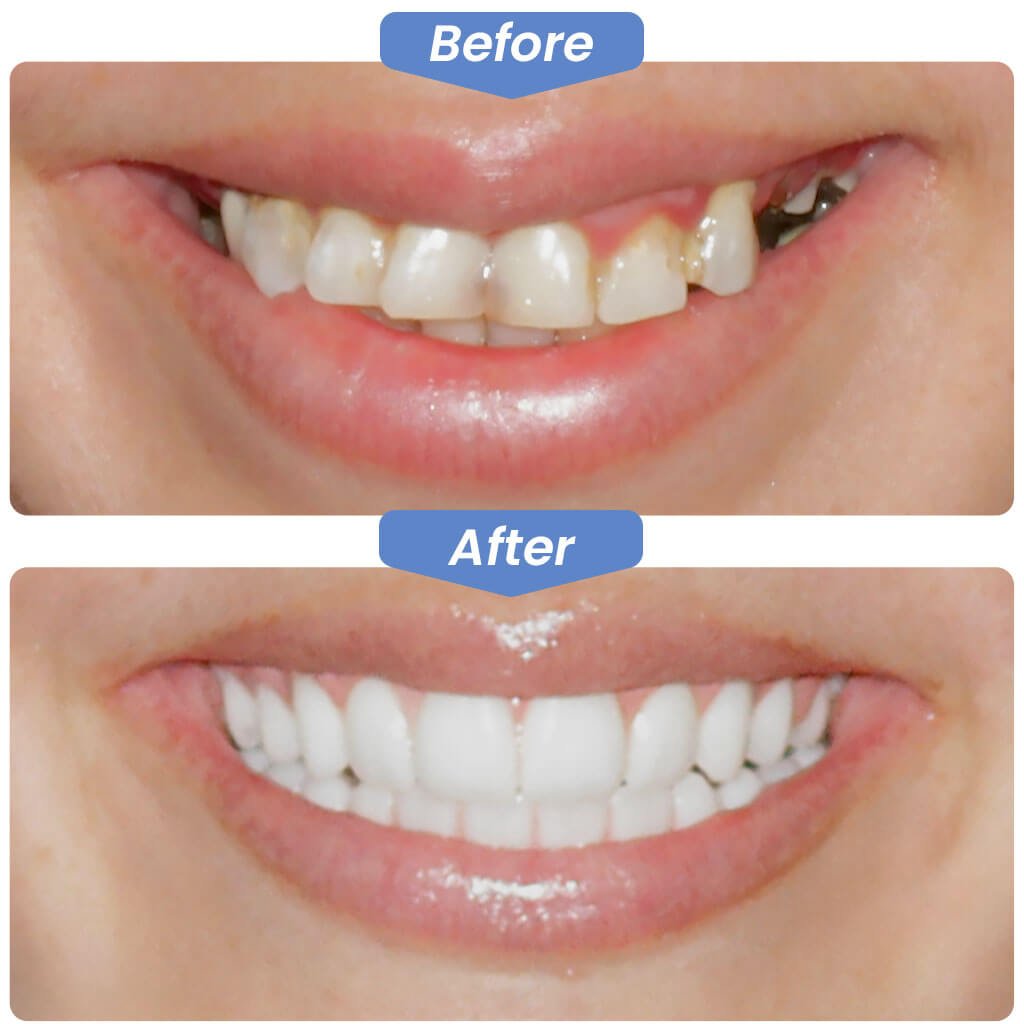 Before-After-Smile-Gallery