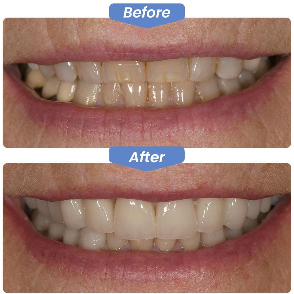 Before-After-Smile-Gallery-3