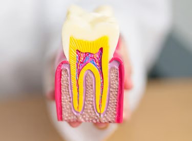 Root Canal Therapy in Stillwater, MN