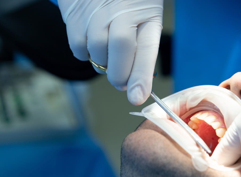 Oral Surgery in Stillwater, MN