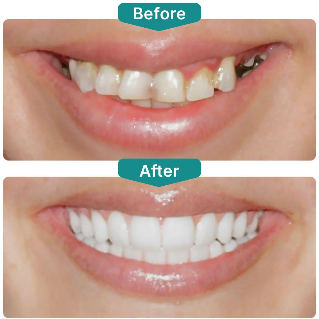 Before After Smile Gallery