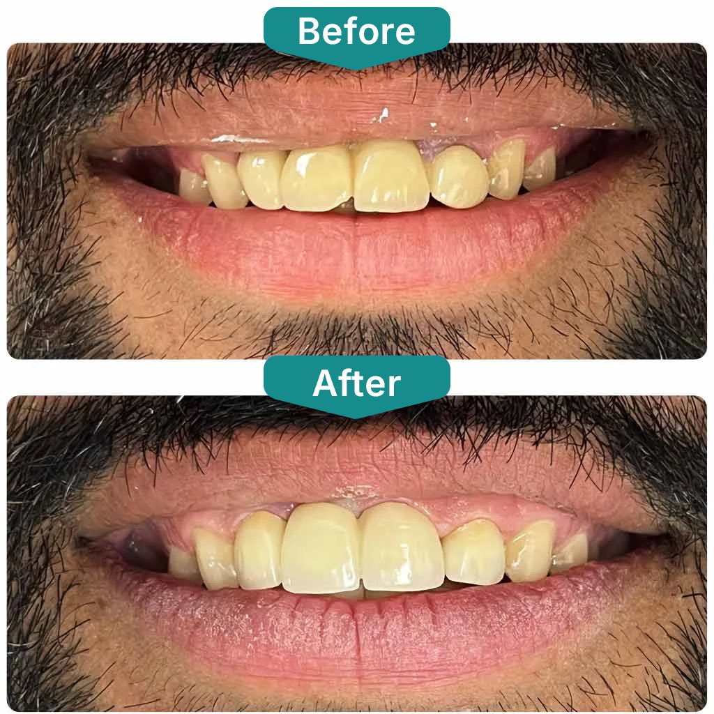 Before After Smile Gallery