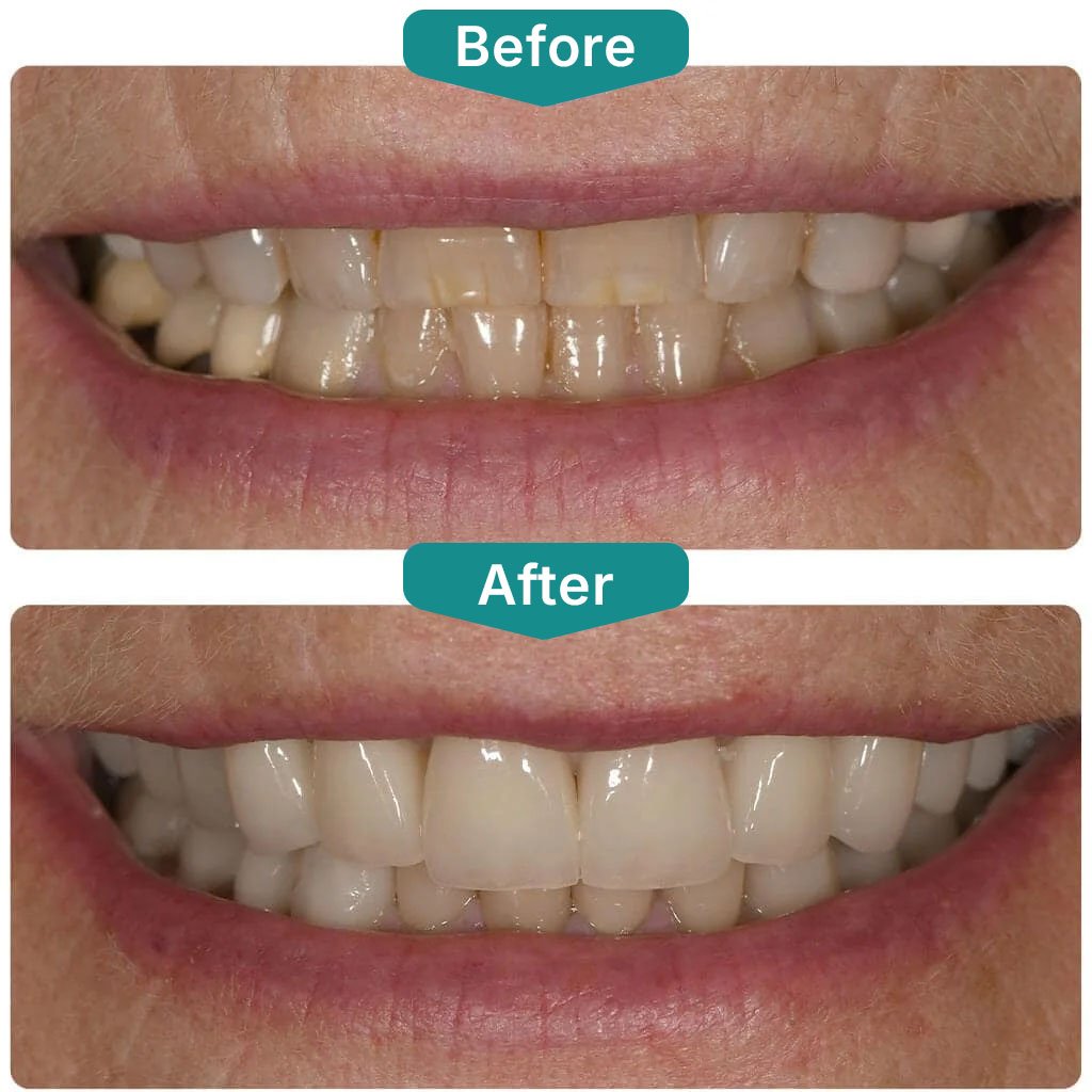 Before After Smile Gallery