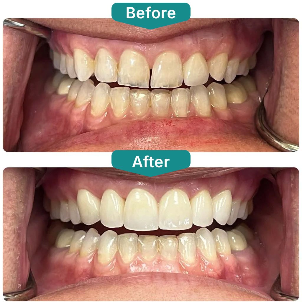 Before After Smile Gallery